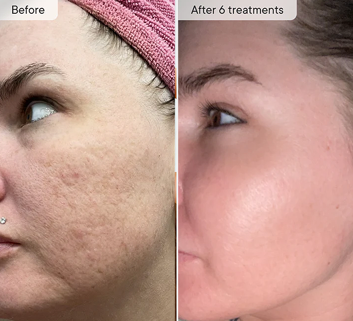 Qyul Korean Micro-Infusion Bundle